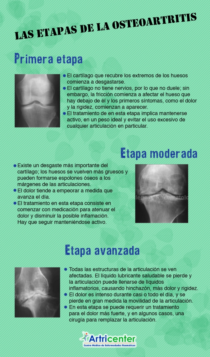 etapas Osteoartritis